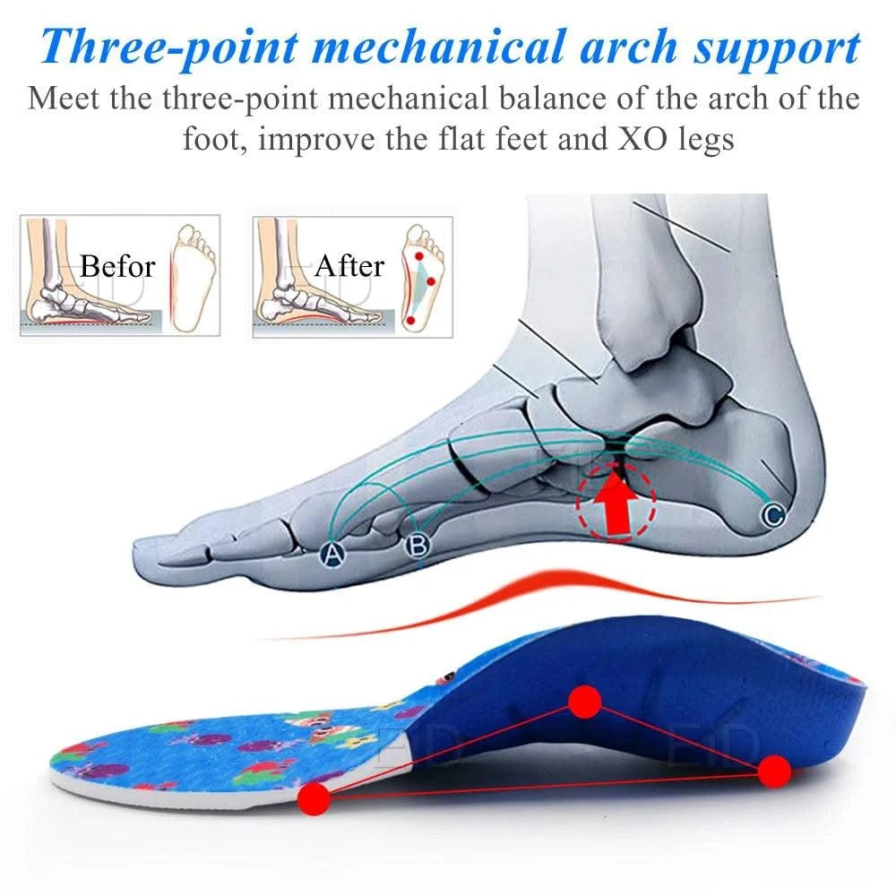 Kids Children 3D Orthopedic Insoles Arch Support insole for OX-Legs Flat Foot insoles Orthotic Pads Correction Health shoes pad