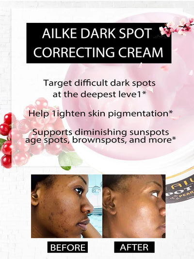 AILKE Dark Spot Corrector Cream, For Face & Body &Armpit,With Organic Arbutin,Intimate Whitening &Clear,Even Skin Tone skincare