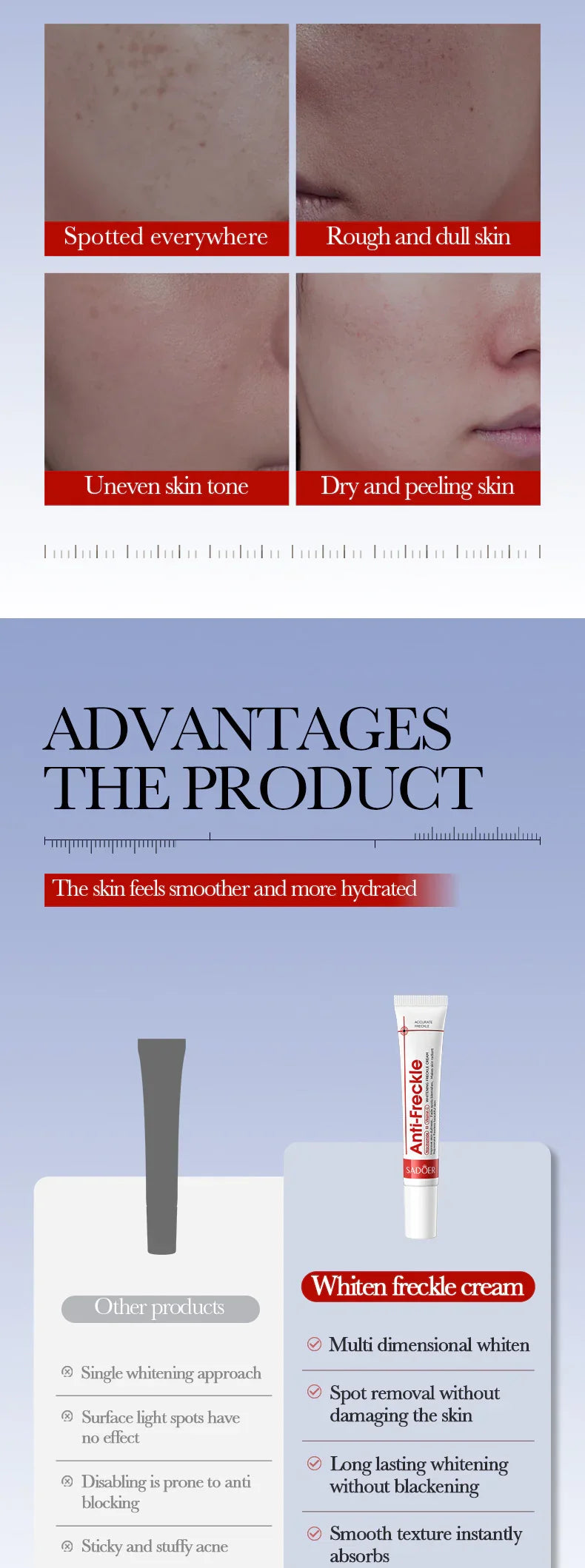 Powerful Whitening Freckles Face Cream Dark Spot Corrector Removal Melasma Fade Melanin Pigmentation Brighten Skin Care Products