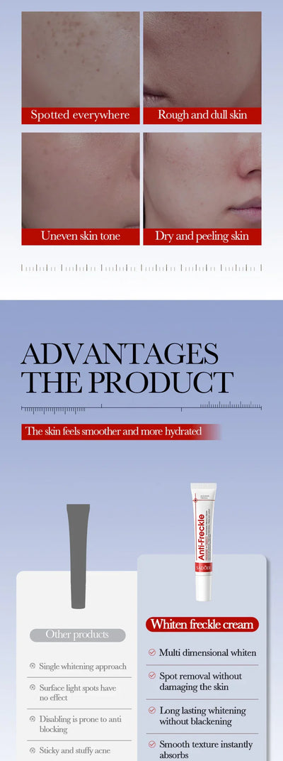 Powerful Whitening Freckles Face Cream Dark Spot Corrector Removal Melasma Fade Melanin Pigmentation Brighten Skin Care Products