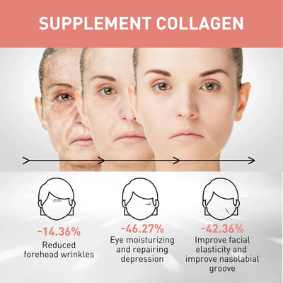 Retinol Night Cream 50g Anti Aging Face Moisturizer Firms Skin Reduces Wrinkles Lines Hydrating Vitamin E Cream for Tightening