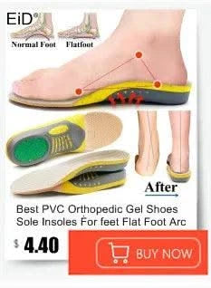 Kids Children 3D Orthopedic Insoles Arch Support insole for OX-Legs Flat Foot insoles Orthotic Pads Correction Health shoes pad