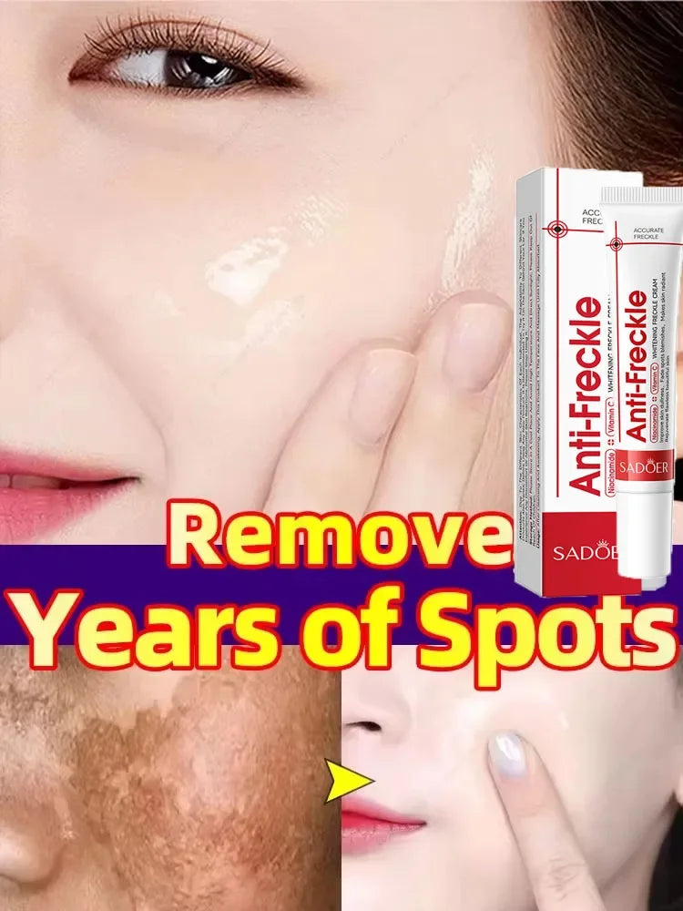 Powerful Whitening Freckles Face Cream Dark Spot Corrector Removal Melasma Fade Melanin Pigmentation Brighten Skin Care Products