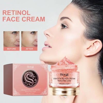 Retinol Night Cream 50g Anti Aging Face Moisturizer Firms Skin Reduces Wrinkles Lines Hydrating Vitamin E Cream for Tightening