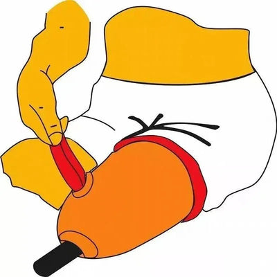 Thigh prosthetic limb accessories prosthetic limb  Pulling traction cloth, residual prosthetic limb, and auxiliary wearing