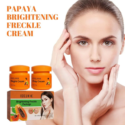 Whitening Freckle Cream Melanin Blemish Remover Lighten Pigmentation Melasma Removal Whiten Nourish Dark Spot Corrector Cream