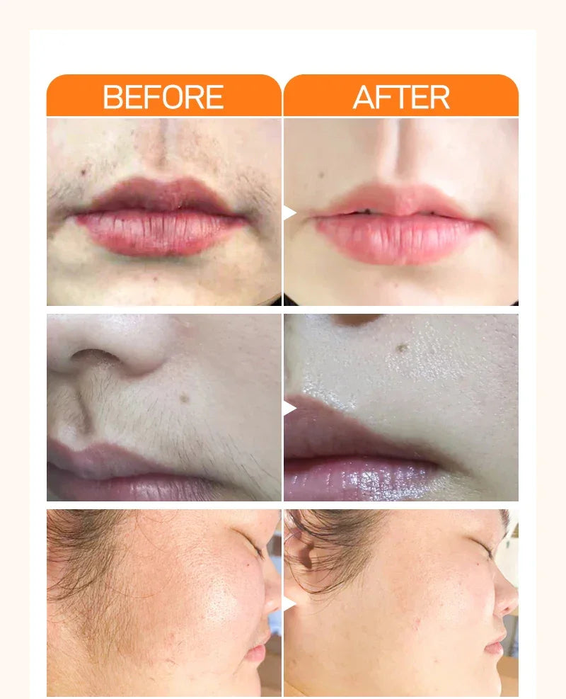 Hair Removal Cream for Ladies Women Depilation Cream Pain Without Underarm Lip Hair Wax Skin Care Facial Hair Removal Cream tool