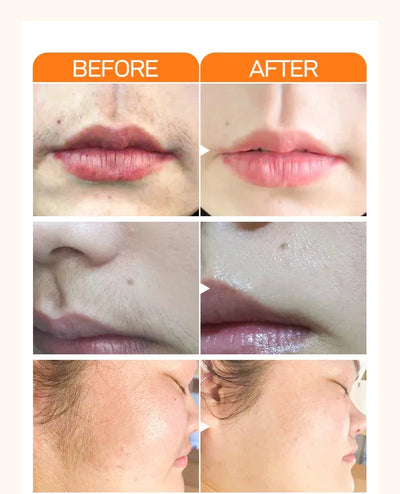 Hair Removal Cream for Ladies Women Depilation Cream Pain Without Underarm Lip Hair Wax Skin Care Facial Hair Removal Cream tool