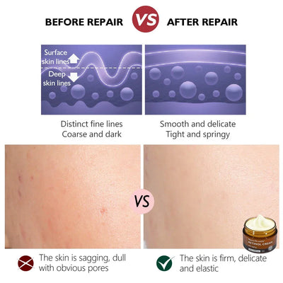 Retinol Face Cream and Eye Serum Firming Lifting Anti-Aging Wrinkle Reduce Wrinkle Fine Lines Facial Skin Care Product