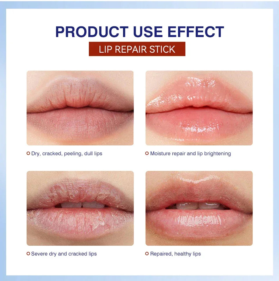 Lakerain Lip Repair Stick 2 Packs Quick Relief Of Dry Moisturizing And Smoothing lip Lines Lip Balm Soothes Chapping Lipstick