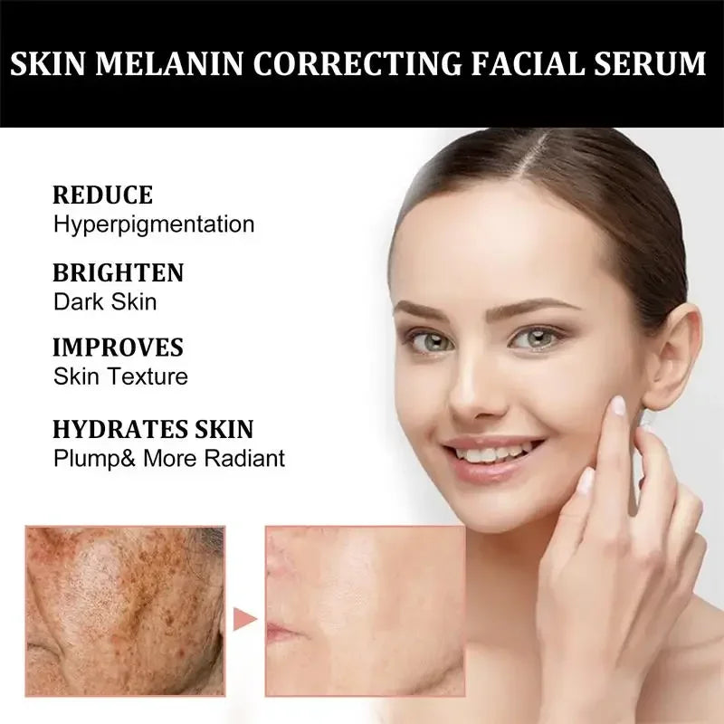Melanin Facial Repair Serum 30ml Hydrating Repairing Dark Skin Whiten Vitamin C Essence Reduces Pigmentation Improve Skin Makeup