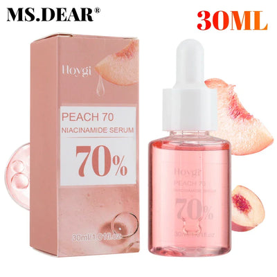 30ml Niacinamide Serum Melanin Removal Fade Melasma Dark Spots Corrector Shrink Pores Hyaluronic Acid Moisturizing Skin Care