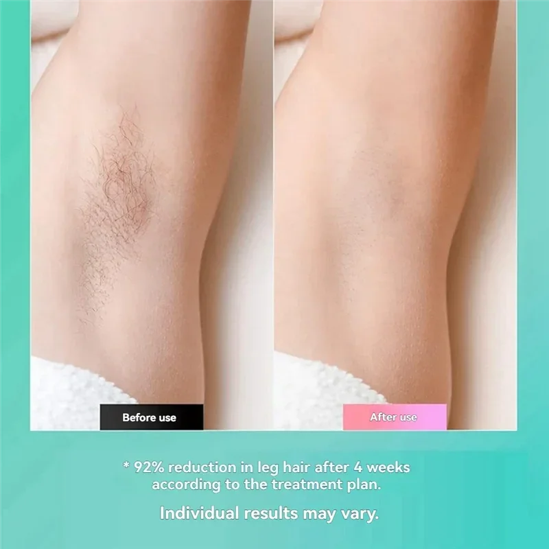 Latest Laserdepilators For Women And Men, Electric Hair Trimmers, Bikinis, Beard Hair Removal And Beauty Kits EU Plug