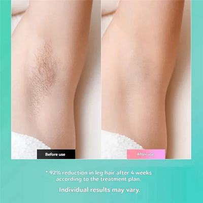 Latest Laserdepilators For Women And Men, Electric Hair Trimmers, Bikinis, Beard Hair Removal And Beauty Kits EU Plug