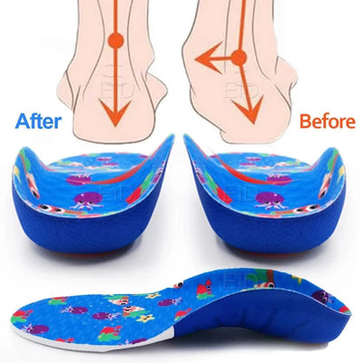 Kids Children 3D Orthopedic Insoles Arch Support insole for OX-Legs Flat Foot insoles Orthotic Pads Correction Health shoes pad