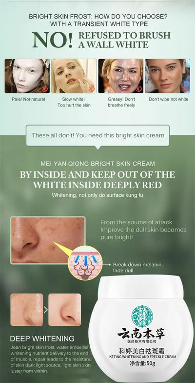 Dark Spot Corrector Skin Whitening Fade Cream Lighten Blemish Removal Serum Reduces Freckles Melasma Sun Spot Brighten Skin Care