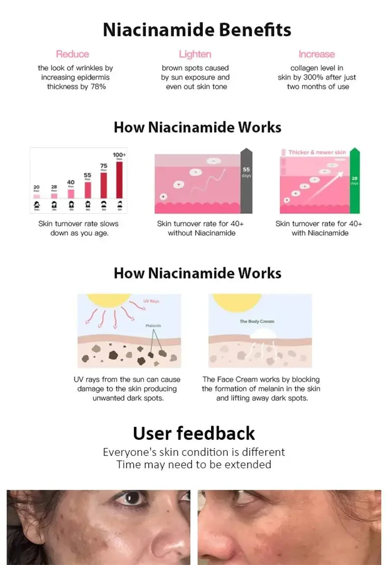 Dark Spot Corrector Skin Whitening Fade Cream Lighten Blemish Removal Serum Reduces Freckles Melasma Sun Spot Brighten Skin Care