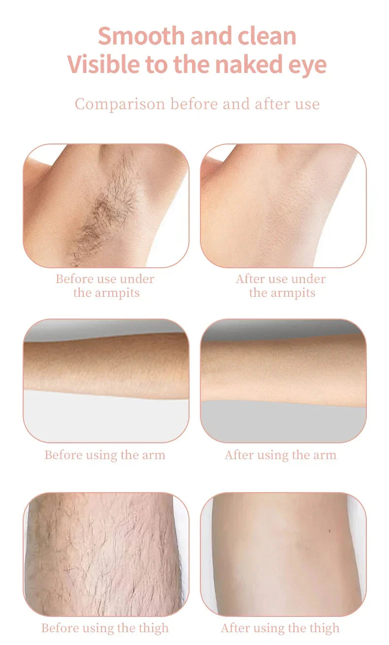 Painless Epilator Electric Shaver for Women Bikini Trimmer Facial Mustache Hair Removal Razor Ladies Face Underarm Legs Electric