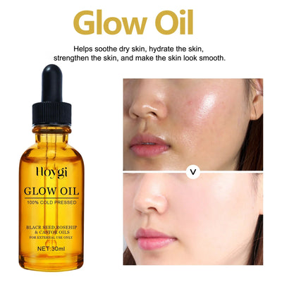 Facial Oil Anti Aging Face Treatment Hydrating Moisturizer Wrinkle Reducer for Dry Skin Rosehip Oil Brightening 30ml Non Greasy