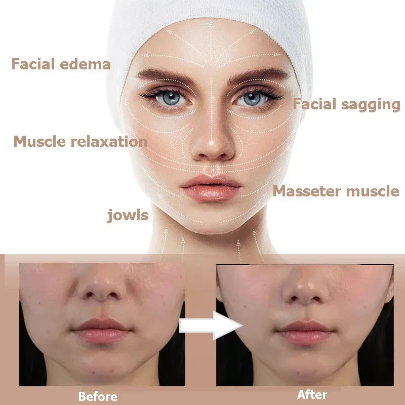 Face Slimming Bandage Women Face Lifting V Line Shaper Chin Cheek Lift Up Belt Anti Wrinkle Strap Facial Beauty Skin Care Tools