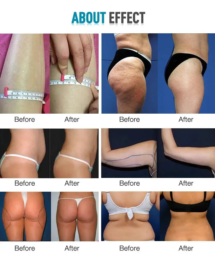 Professional 80K Cavitation Vacuum Bipolar RF for Face Slimming and Firming Beauty Machine