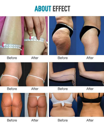 Professional 80K Cavitation Vacuum Bipolar RF for Face Slimming and Firming Beauty Machine