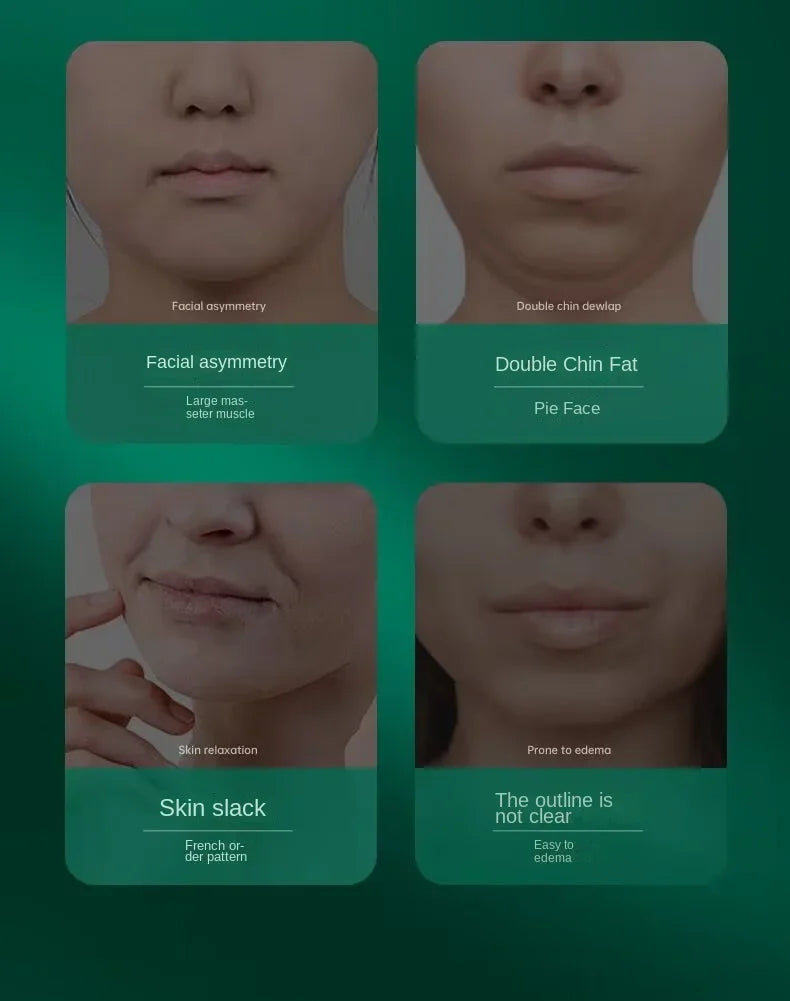 Face slimming bandage v face lifting tighten facial nasolabial folds double chin to improve sleep facial engraving mask lifting