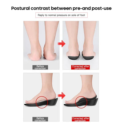 Flat Foot O-shaped Legs Arch Support Plantar Unisex Large Size Insole for Fasciitis Shoes Orthopedic Insoles for Flat Feet Pad