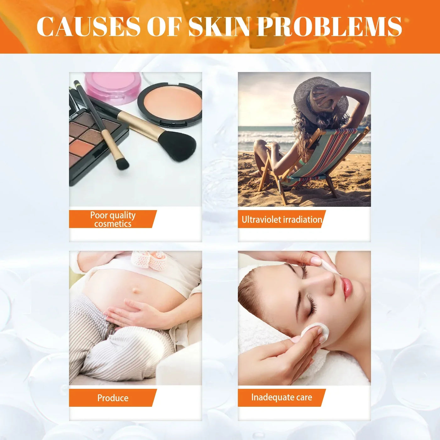 Whitening Freckle Cream Melanin Blemish Remover Lighten Pigmentation Melasma Removal Whiten Nourish Dark Spot Corrector Cream