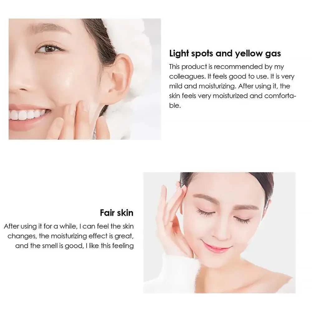 Dark Spot Corrector Skin Whitening Fade Cream Freckle Removing Face Cream Lightening Blemish Removal Serum Skin Care