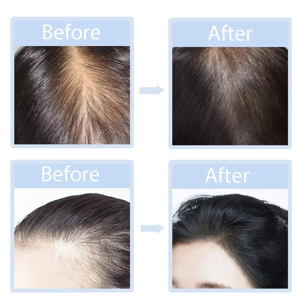 LED Red Light Therapy Massage Cap For Preventing Hair Loss Used For Professional Treatment Of Hair Loss Growth  Repair Of Dry