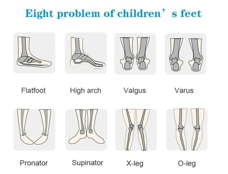 Boys Children Orthopedic Shoes For Kids Summer Sandals Toddler Leather Varus Clubfoot Footwear 2-8Year