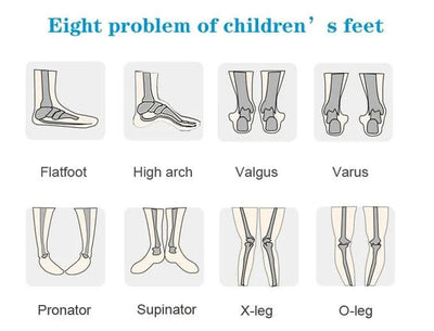 Boys Children Orthopedic Shoes For Kids Summer Sandals Toddler Leather Varus Clubfoot Footwear 2-8Year