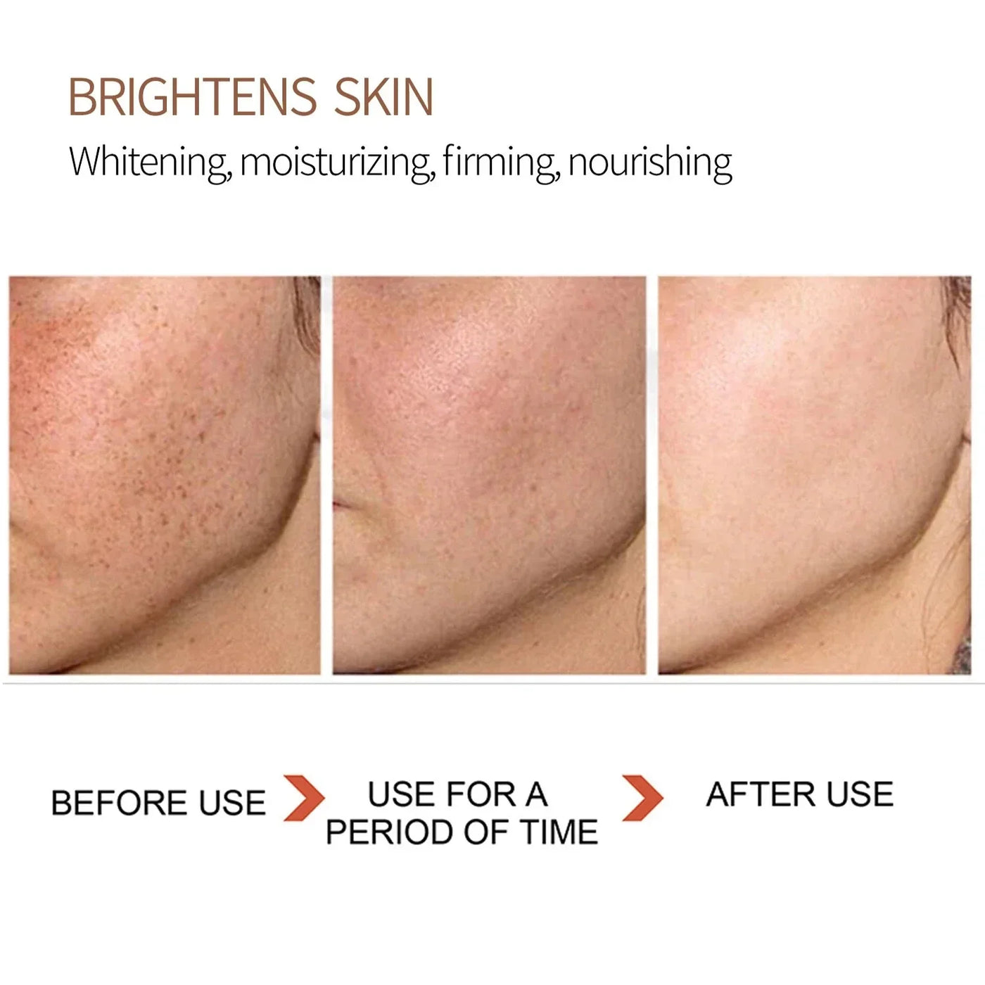 Serum for Face & Eye for Dark Spot Corrector