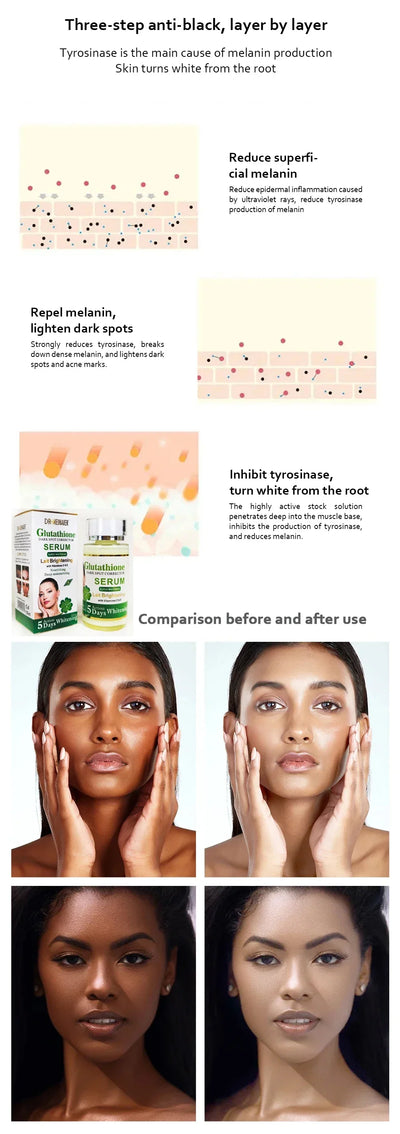 Serum for Face & Eye for Dark Spot Corrector