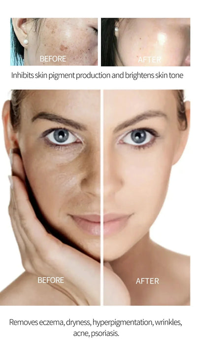 Serum for Face & Eye for Dark Spot Corrector