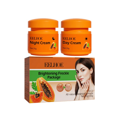 Whitening Freckle Cream Melanin Blemish Remover Lighten Pigmentation Melasma Removal Whiten Nourish Dark Spot Corrector Cream