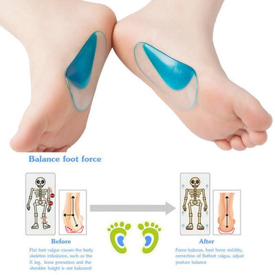 Kids Orthopedic Insoles for Children Shoes Inserts Baby Plantar Fasciitis Flat Feet Arch Support Orthotic Silicone Gel Insoles