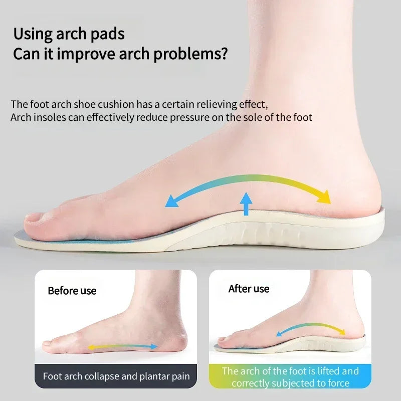 Orthopedic Arch Support Insoles for Plantar Fasciitis Flat Feet  Shock Absorption Shoe Inserts for Sport Shoes  Pain Relief Pads