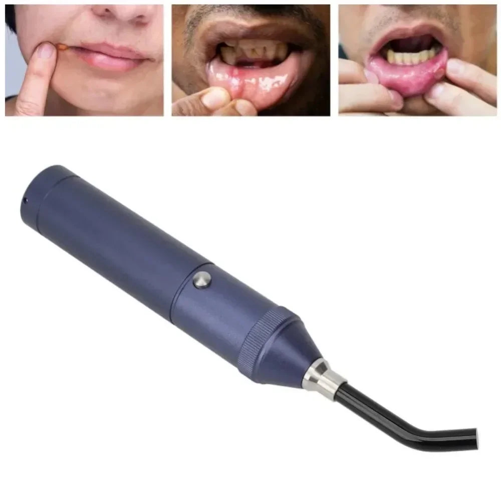 Led Red Blue Light Canker Sore Care Treatment Wand Skin Therapy Flashlight  Relief Pain Infrared Anti Inflammatory Wound Healing