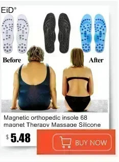 Kids children 3d orthopedic insoles arch support insole for ox-legs flat foot insoles orthotic pads correction health