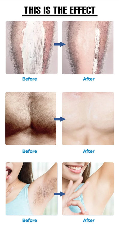 Permanent Hair Removal Cream Painless Intimate Parts Legs Body Armpit Depilatory For Man Women Whitening Body Care Products 100g