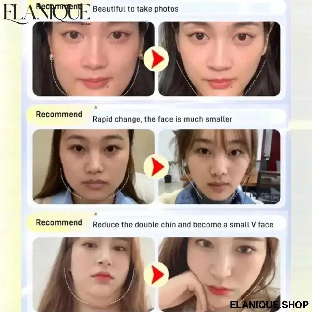 Chin Cheek Slimming Bandage - V Shaper V Line Lifting Anti Wrinkle Mask - Elanique