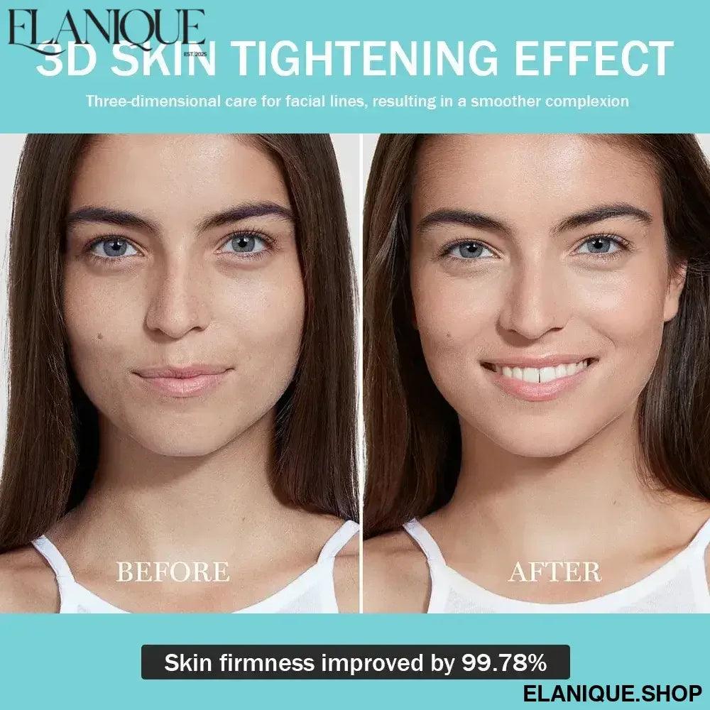 Facial Age-R Booster H Skin Care Facial Skin Care Tools Anti Aging Microcurrent Lift Face Care Therapy Home Beauty Device - Elanique