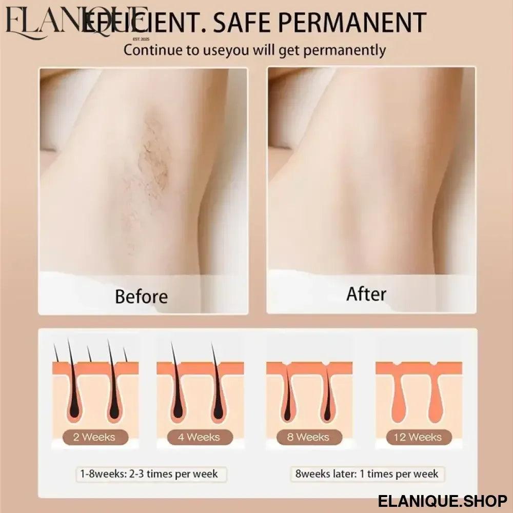 IPL Laser Hair Removal Device Portable and Rechargeable Long-Lasting Hair Removal for Face Legs and Armpits Excellent Quality - Elanique